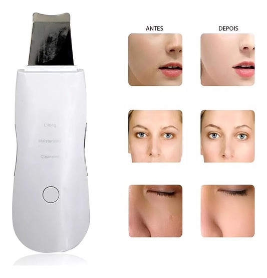 Limpiador Facial Ultrasonico